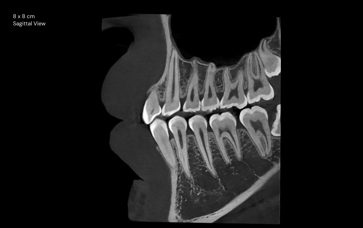 8 x 8 cm Sagittal View